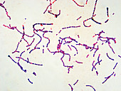 Streptococcus pneum 600x - Streptococcus pneumoniae 600-1