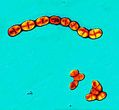 Streptococcus mutans bacteria, TEM