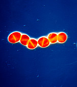 Streptococcus pneumoniae bacteria, TEM