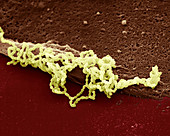 Streptococc pneum 3300x - Streptococcus pneumoniae 3300x
