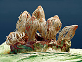 Rust fungus, SEM