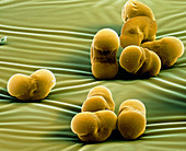 Tannen Pollen 320x - Pollen, Tanne