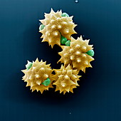 Ox-eye daisy pollen, SEM