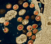 Chlamydia trachomatis 32000x - Parasiten, Bakterien Chlamydia Trachomatis 32000-1