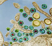 Herpes simplex virus particles, TEM