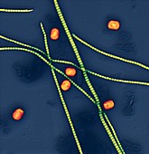 MCV Dellwarzen 30kx - Molluscipoxvirus und Bindegewebsfasern 30 000-1