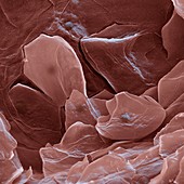 Plattenepithel 1200x - Platenepithel-Zellen der Zunge 1200-1