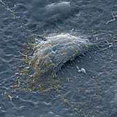 Contaminated cell in culture, SEM