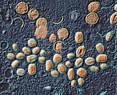 Vaccinia virus particles, TEM