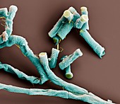 Bac anthr Sporen 10kx - Bakterien, Bacillus anthracis, Sporen 10 000-1