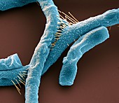Bac anthracis 20kx - Bakterien, Bacillus anthracis, 20 000-1
