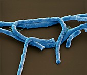 Bac anthracis 8kx - Bakterien, Bacillus anthracis, 8 000-1