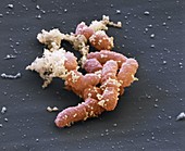 Coxiella 30kx - Proteobacteria, Coxiella burnetii 30 000-1