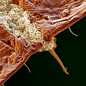 Scale insect secretions, SEM