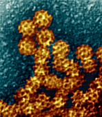 Caliciviridae virus particles, TEM
