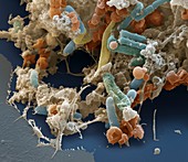 Dechlorinating bacteria, SEM