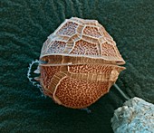 Dinoflagellate protozoan, SEM