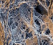 Nanofib Cellul 1500x - Nanofibrillierte Cellulose, 1500-1
