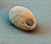 Rhizaria protozoan, SEM