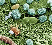 Bacteria on aphid, SEM