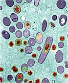 Bacillus anthracis, Milzbrand 10 000:1