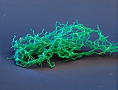 Lyme disease bacteria, SEM