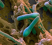 Clostridium botulinum bacteria, SEM