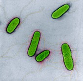 E. coli bacteria, TEM