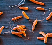 Helicobacter pylori bacteria, SEM