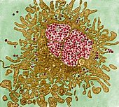 HIV in Zelle - HIV um und in Lymphozyten 10 000-1