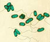 Legionella pneumophila, 8000:1