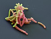 Mycobacterium tuberculosis 13 000:1
