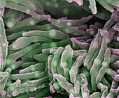 Mycobacterium tuberculosis 20 000:1