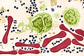 Bacterial blood infection, TEM