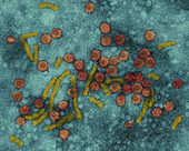 Hepatitis B virus particles, TEM