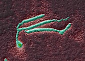 Ebola-Viren 30000x