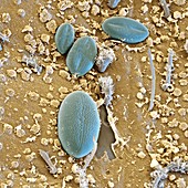 Diatoms on mayfly nymph, SEM
