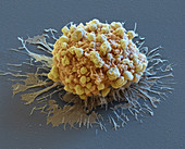 Apoptosis, SEM