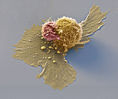 Cancer immunotherapy, SEM