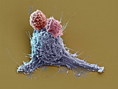 Mammakarzinom-Zellen mit CAR-Zellen, 4800:1