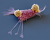 Cancer immunotherapy, SEM