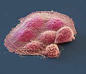 Ovarian cancer cell, SEM