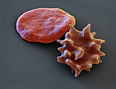 Normal and echinocyte red blood cells, SEM