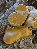 Fat cells, SEM