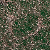 Neuronale Vorlaeuferzelle 240x - Neuronale Vorläuferzellen, human (Neuronal Progenitor Cells) 240x 4