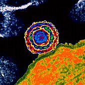 Herpes simplex virus