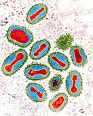 Smallpox viruses