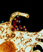 Coloured TEM of yellow fever virus attacking cell