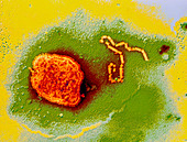 Coloured TEM of a mumps virus