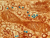 Coloured TEM of Rubella virus particles in cell